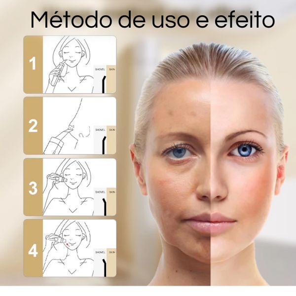 Massageador Facial Ultrassônico Removedor de Acne
