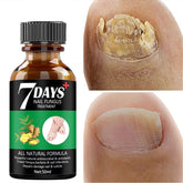 Sérum Antifúngico Reparador de Cutículas e Unhas Natural
