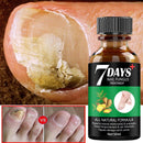 Sérum Antifúngico Reparador de Cutículas e Unhas Natural